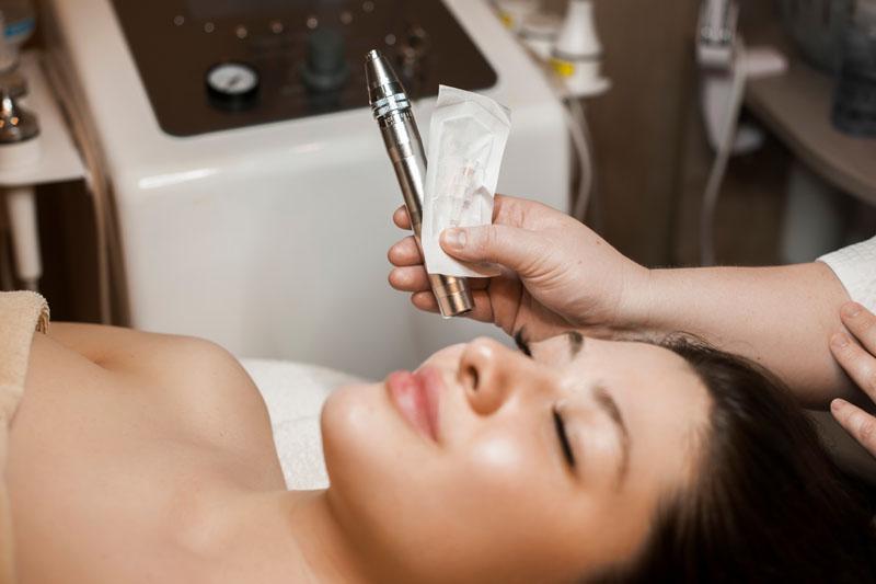 Microneedling